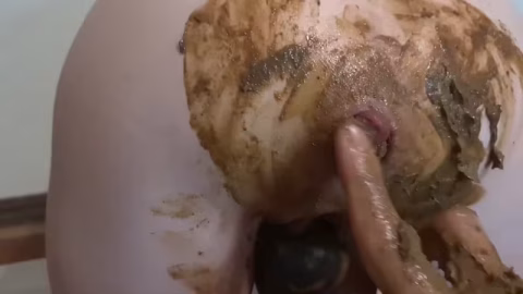 Rosebud Is Back Bizarre Shitty Anal Prolapse