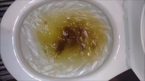 Stomach Hurts Rosebud Diarrhea And Farts
